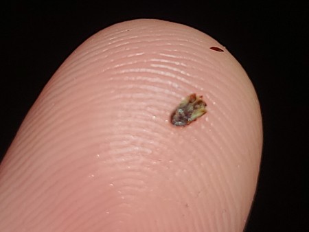 A crushed bug on a fingertip.