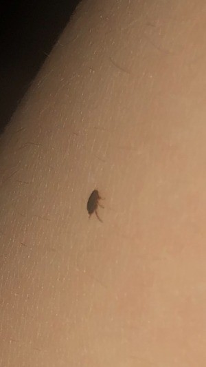 A small bug on a leg.