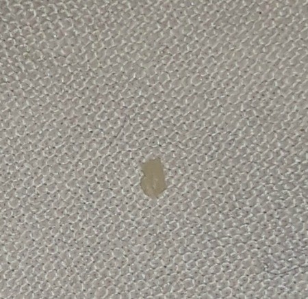 A small blob on a woven background.