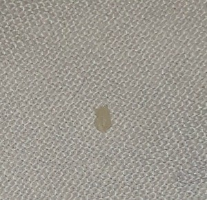 A small blob on a woven background.