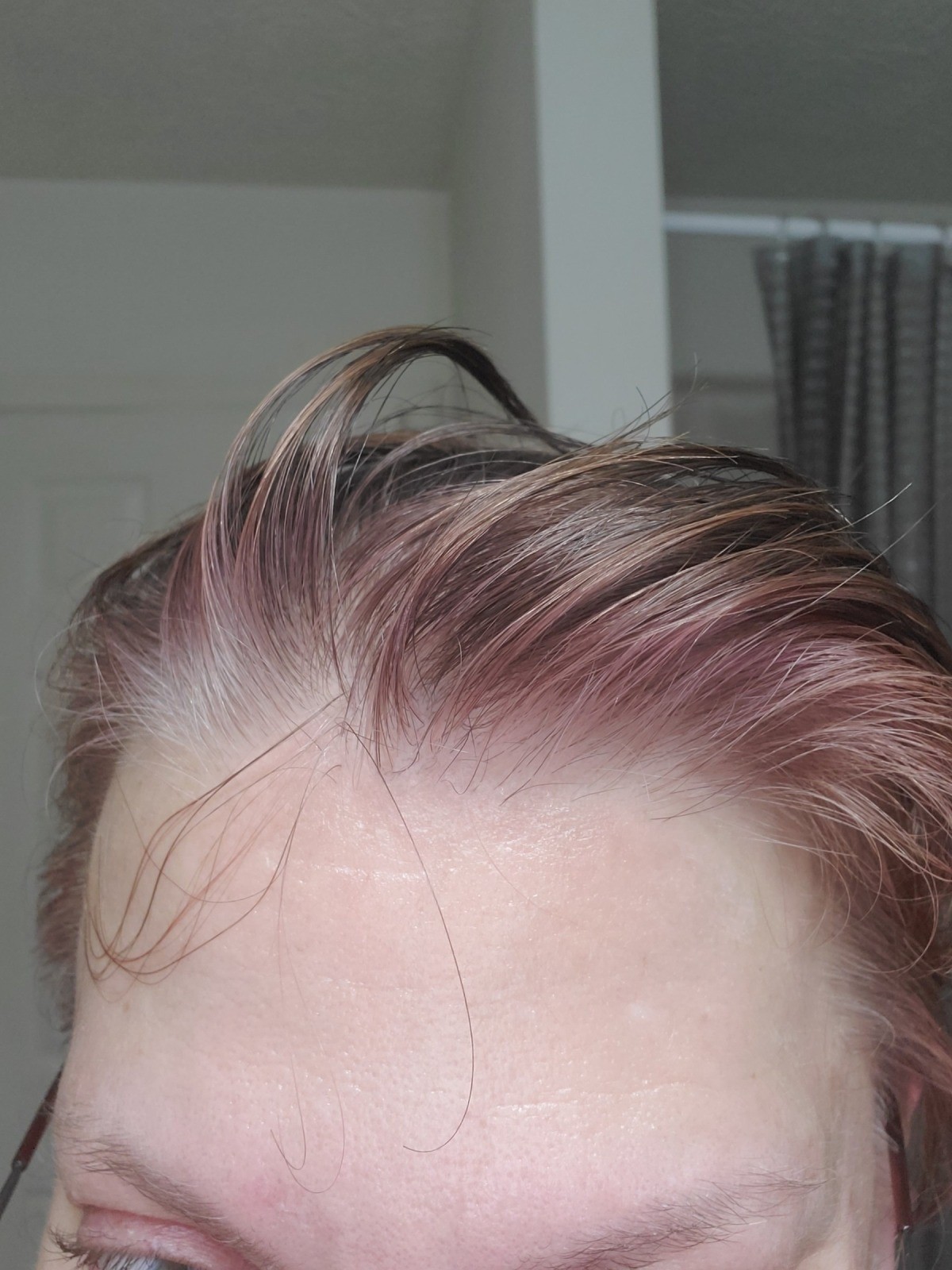 Hair Turned Pink When Dyed Thriftyfun