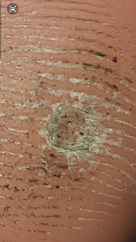 A marking on the bottom of a foot.