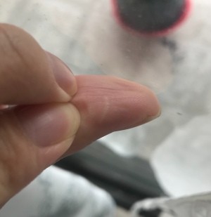 A small white line on a thumb.