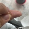 A small white line on a thumb.