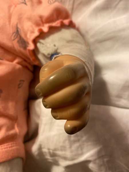 Discolored fingers on a doll.