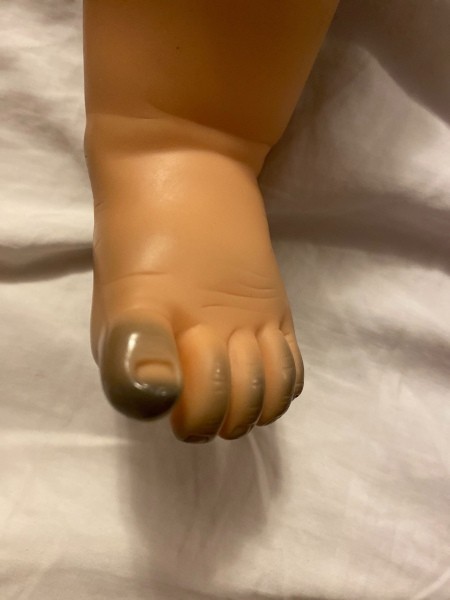 Discolored toes on a baby doll.