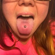 A red spot around a tongue piercing.