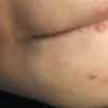 A small round blemish near a person's lip.