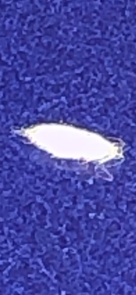 A blurry fuzzy closeup.