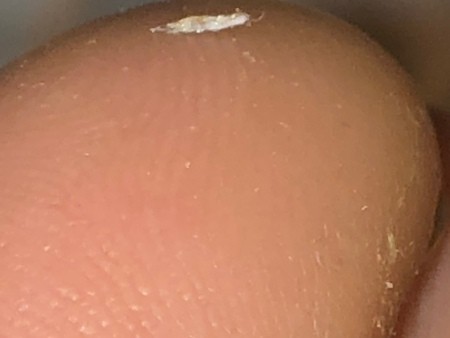 A white fuzz on a fingertip.
