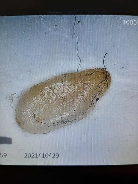 A close up of a bug.