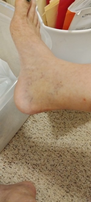 a picture of a foot.