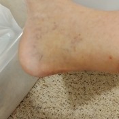 a picture of a foot.