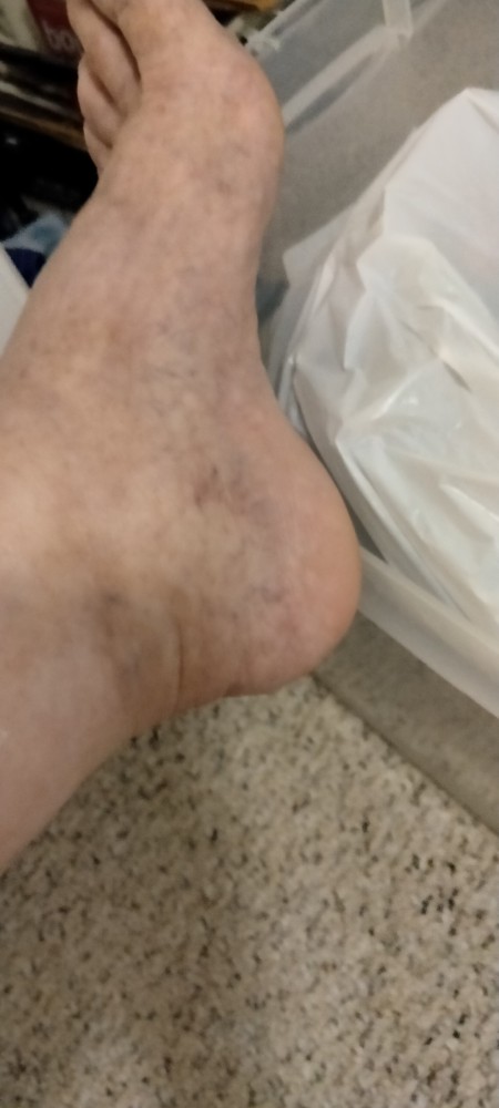 A picture of a foot