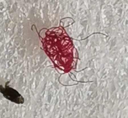 Parasite On My Head?