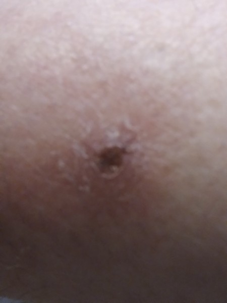 Identifying a Tiny Black Bug?