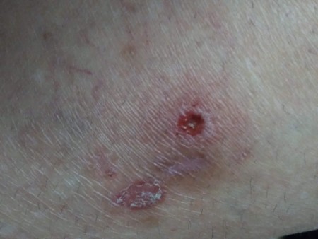 Identifying a Tiny Black Bug?