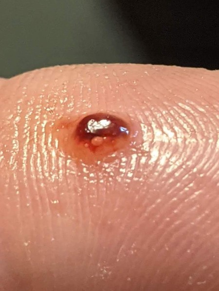 Identifying a Tiny Black Bug?