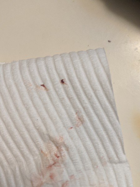 Identifying a Tiny Black Bug?