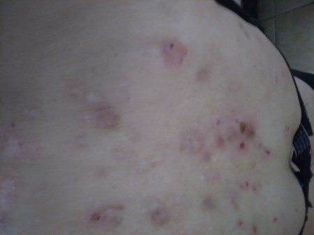 Identifying a Tiny Black Bug?