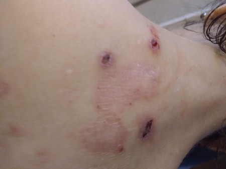 Identifying a Tiny Black Bug?