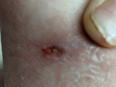 Identifying a Tiny Black Bug?