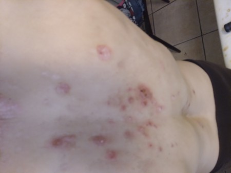 Identifying a Tiny Black Bug?