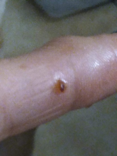 Identifying a Tiny Black Bug?