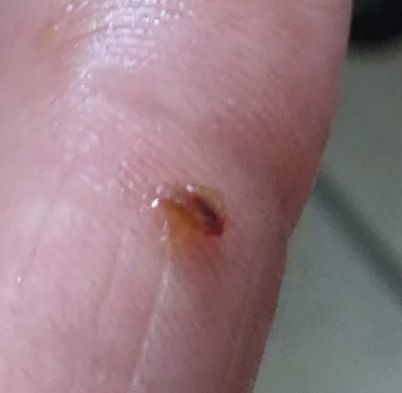 Identifying a Tiny Black Bug?