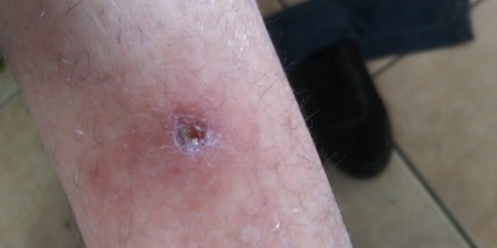 Identifying a Tiny Black Bug?