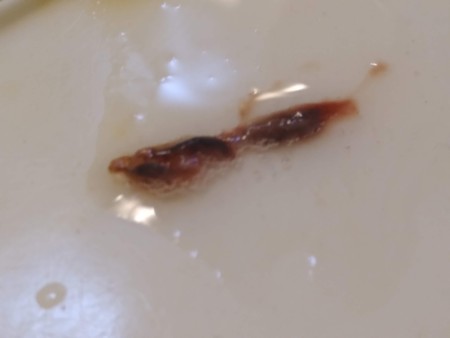 Identifying a Tiny Black Bug?
