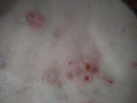 Identifying a Tiny Black Bug?