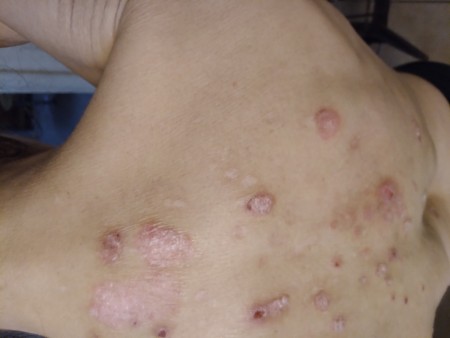 Identifying a Tiny Black Bug?