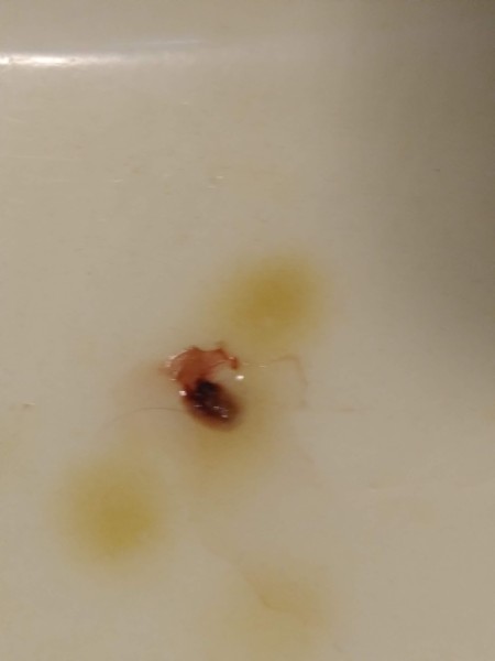 Identifying a Tiny Black Bug?