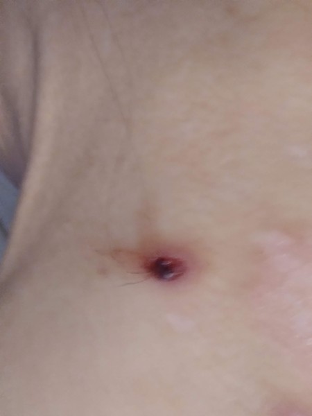 Identifying a Tiny Black Bug?