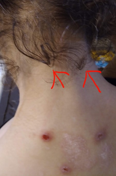 Identifying a Tiny Black Bug?