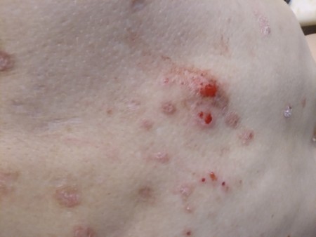 Identifying a Tiny Black Bug?