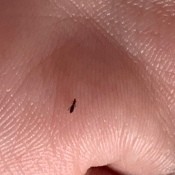 A small fly on someone's skin.