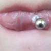 Infected Tongue Piercing?